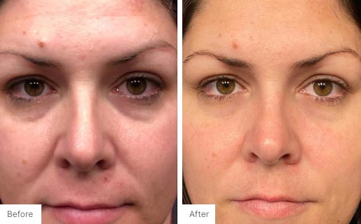 8 - Before and After Real Results image of a woman's face.